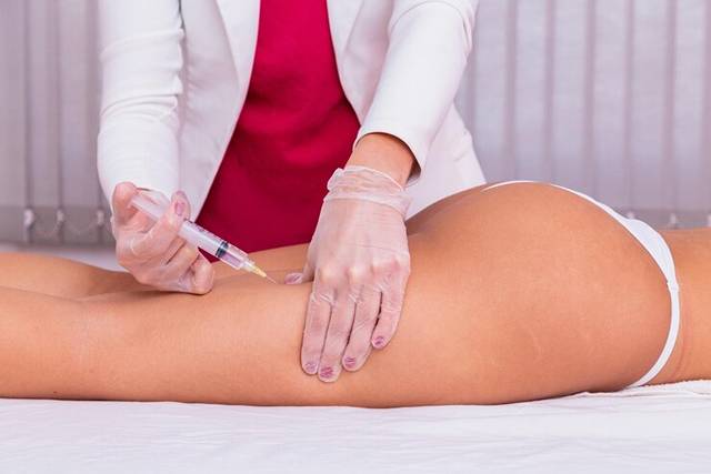 Intradermoterapia