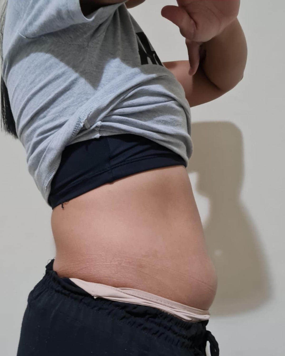 Antes - Lipo Química