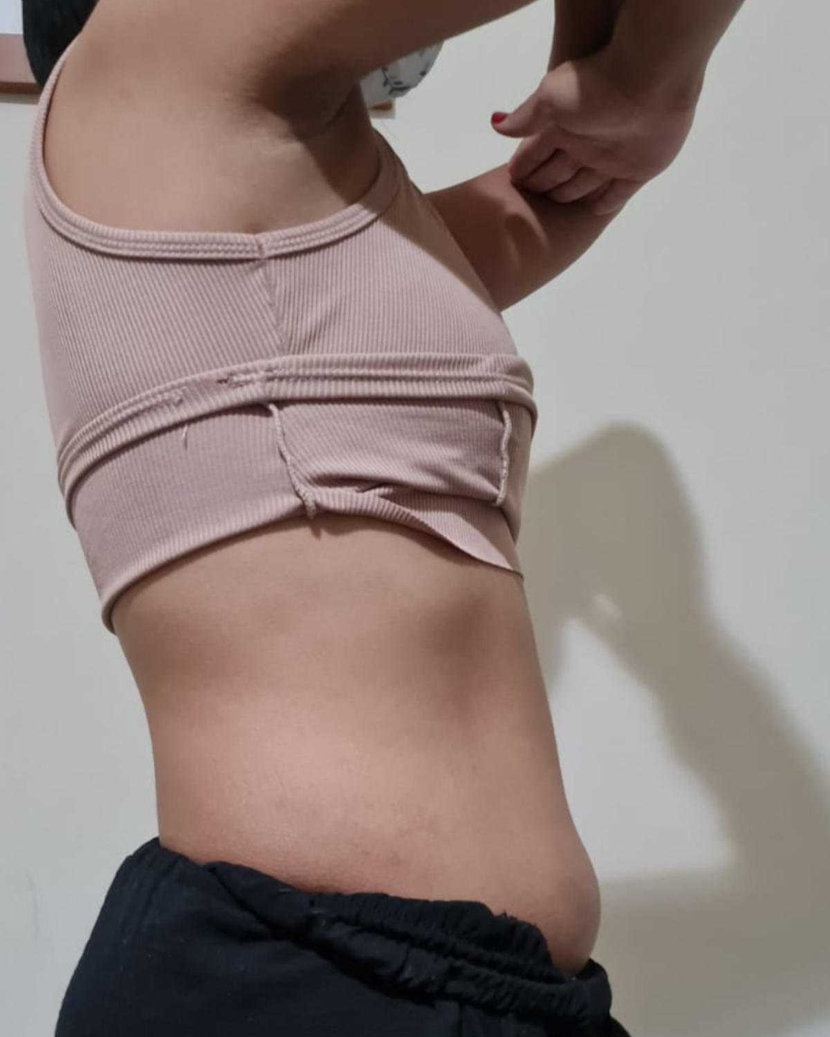 Depois - Lipo Química